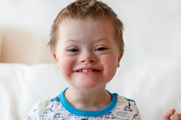 Down Syndrome